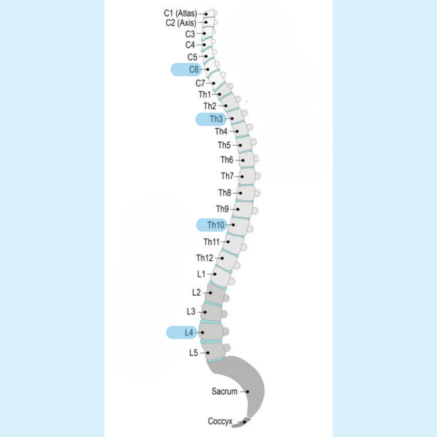 Spinal model vertebrae showing locations C6, Th3, Th10, and L4.