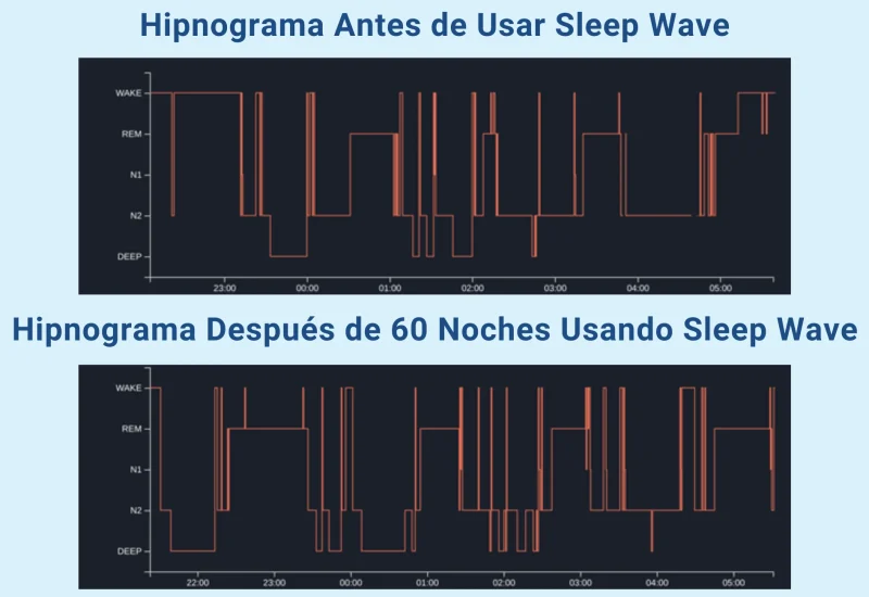 Hipnograma antes e despues de usar Sleep Wave